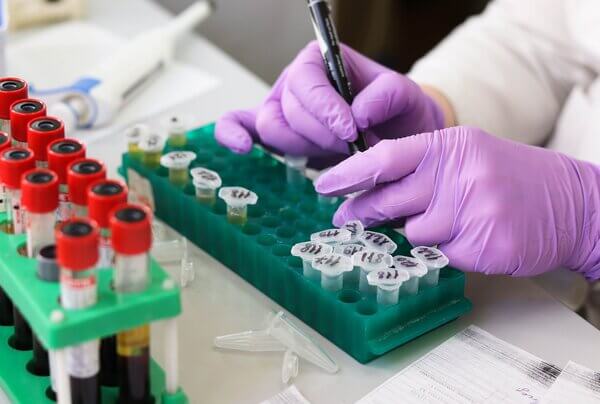 RESEARCH & INNOVATION-Nutrayours